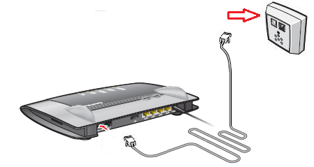 vdsl-rc-install-1.png